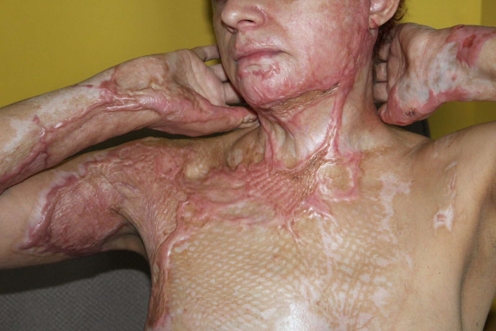 Podopieczny