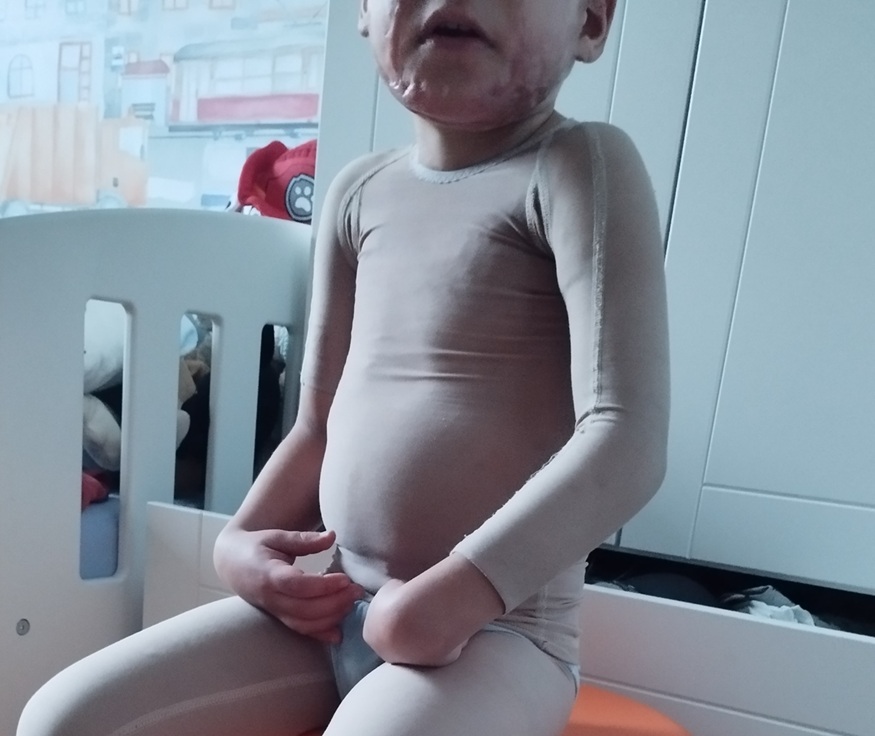 Podopieczny